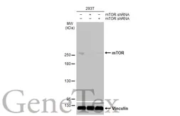 Anti-mTOR antibody [HL2217] used in Western Blot (WB). GTX638221