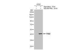 Anti-PAI2 antibody [HL2218] used in Western Blot (WB). GTX638222