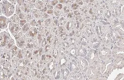 Anti-PAI2 antibody [HL2218] used in IHC (Paraffin sections) (IHC-P). GTX638222