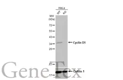 Anti-Cyclin D1 antibody [HL2219] used in Western Blot (WB). GTX638223