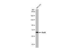 Anti-RelB antibody [HL2222] used in Western Blot (WB). GTX638267