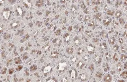 Anti-FN3K antibody [HL2223] used in IHC (Paraffin sections) (IHC-P). GTX638268