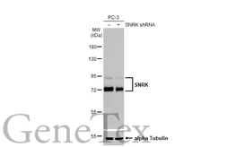 Anti-SNRK antibody [HL2225] used in Western Blot (WB). GTX638270