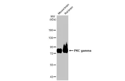 Anti-PKC gamma antibody [HL2226] used in Western Blot (WB). GTX638271