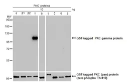 Anti-PKC gamma antibody [HL2227] used in Western Blot (WB). GTX638272