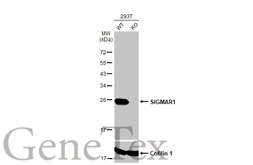 Anti-SIGMAR1 antibody [HL2230] used in Western Blot (WB). GTX638275