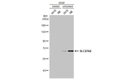 Anti-SLC27A2 antibody [HL2232] used in Western Blot (WB). GTX638277