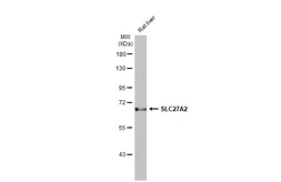 Anti-SLC27A2 antibody [HL2232] used in Western Blot (WB). GTX638277