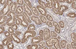 Anti-SLC27A2 antibody [HL2232] used in IHC (Paraffin sections) (IHC-P). GTX638277