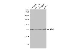 Anti-SPG7 antibody [HL2236] used in Western Blot (WB). GTX638281