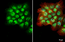 Anti-p53 antibody [HL2242] used in Immunocytochemistry/ Immunofluorescence (ICC/IF). GTX638291