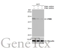 Anti-IPMK antibody [HL2244] used in Western Blot (WB). GTX638293