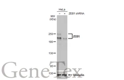 Anti-ZEB1 antibody [HL2245] used in Western Blot (WB). GTX638294