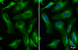Anti-RIP antibody [HL2249] used in Immunocytochemistry/ Immunofluorescence (ICC/IF). GTX638298