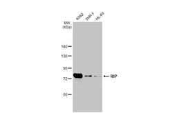 Anti-RIP antibody [HL2250] used in Western Blot (WB). GTX638299