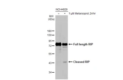 Anti-RIP antibody [HL2250] used in Western Blot (WB). GTX638299