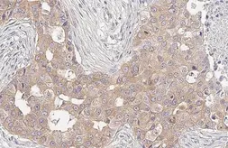 Anti-RIP antibody [HL2250] used in IHC (Paraffin sections) (IHC-P). GTX638299