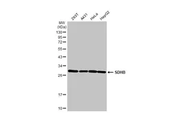 Anti-SDHB antibody [HL2251] used in Western Blot (WB). GTX638300