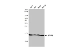 Anti-RPLP2 antibody [HL2256] used in Western Blot (WB). GTX638308