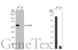 Anti-ETS2 antibody [HL2258] used in Western Blot (WB). GTX638310
