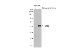 Anti-ETS2 antibody [HL2258] used in Western Blot (WB). GTX638310