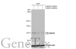 Anti-CARD10 antibody [HL2260] used in Western Blot (WB). GTX638312