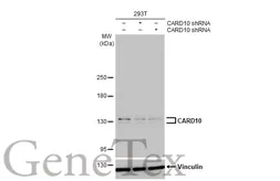 Anti-CARD10 antibody [HL2261] used in Western Blot (WB). GTX638313