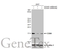 Anti-COX4 antibody [HL2264] used in Western Blot (WB). GTX638316