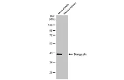 Anti-Stargazin antibody [HL2268] used in Western Blot (WB). GTX638320