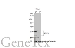 Anti-KLF5 antibody [HL2269] used in Western Blot (WB). GTX638321