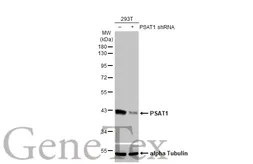 Anti-PSAT1 antibody [HL2270] used in Western Blot (WB). GTX638322