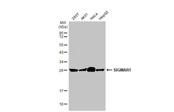 Anti-SIGMAR1 antibody [HL2274] used in Western Blot (WB). GTX638326