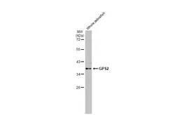Anti-GPS2 antibody [HL2276] used in Western Blot (WB). GTX638329