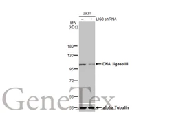 Anti-DNA ligase III antibody [HL2280] used in Western Blot (WB). GTX638333