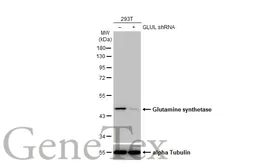 Anti-Glutamine synthetase antibody [HL2283] used in Western Blot (WB). GTX638336