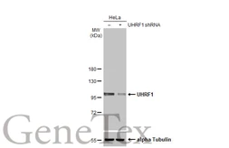 Anti-UHRF1 antibody [HL2287] used in Western Blot (WB). GTX638342