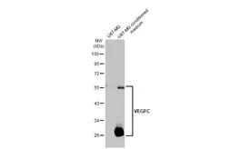 Anti-VEGFC antibody [HL2289] used in Western Blot (WB). GTX638344