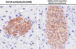 Anti-GLP1R antibody [HL2298] used in IHC (Paraffin sections) (IHC-P). GTX638353