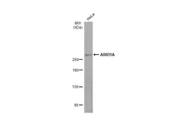 Anti-ARID1A antibody [HL2304] used in Western Blot (WB). GTX638371