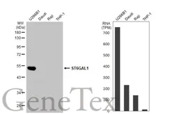 Anti-ST6GAL1 antibody [HL2318] used in Western Blot (WB). GTX638481
