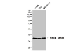 Anti-CDK4 + CDK6 antibody [HL2323] used in Western Blot (WB). GTX638486