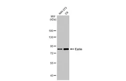 Anti-Ezrin antibody [HL2327] used in Western Blot (WB). GTX638490