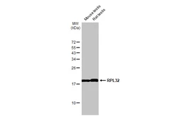 Anti-RPL32 antibody [HL2331] used in Western Blot (WB). GTX638494