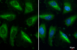 Anti-RPL32 antibody [HL2331] used in Immunocytochemistry/ Immunofluorescence (ICC/IF). GTX638494