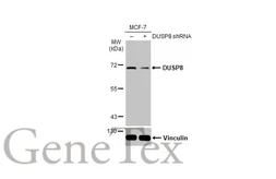 Anti-DUSP8 antibody [HL2338] used in Western Blot (WB). GTX638541
