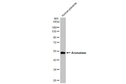 Anti-Aromatase antibody [HL2339] used in Western Blot (WB). GTX638542