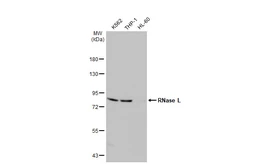 Anti-RNase L antibody [HL2340] used in Western Blot (WB). GTX638543