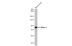 Anti-RNase L antibody [HL2341] used in Western Blot (WB). GTX638544