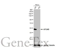 Anti-ATG4B antibody [HL2348] used in Western Blot (WB). GTX638551