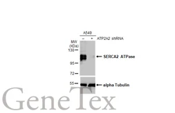 Anti-SERCA2 ATPase antibody [HL2352] used in Western Blot (WB). GTX638555